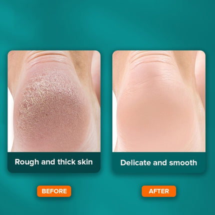 Double Side Stainless Steel Foot File – Pedicure Callus Remover