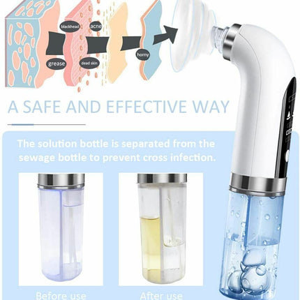 Vacuum Blackhead Remover Facial Pore Suction Cleaner for Acne & Pimples
