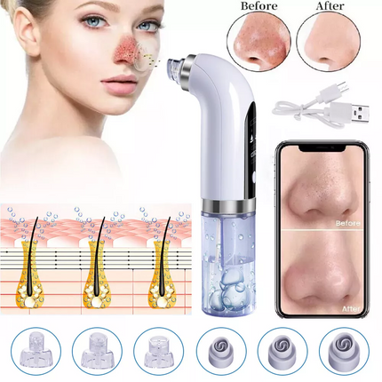 Vacuum Blackhead Remover Facial Pore Suction Cleaner for Acne & Pimples