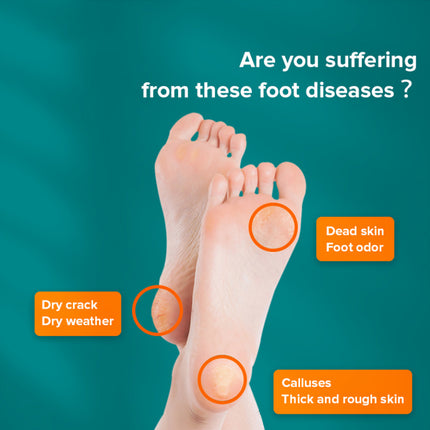 Double Side Stainless Steel Foot File – Pedicure Callus Remover